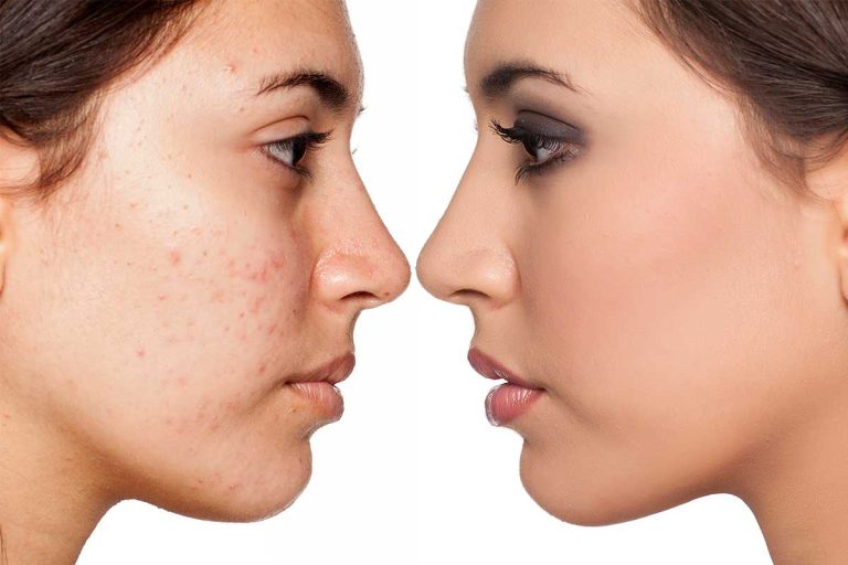 Get professional tips to safe your skin from Perfect Skin MD