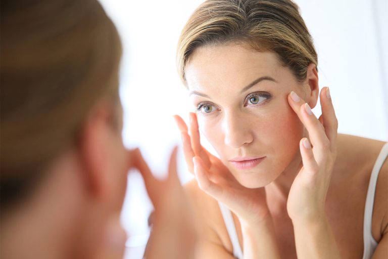 Botox for Crow's Feet in Juno Beach FL Area