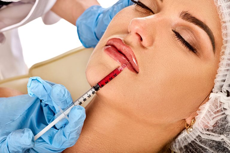 Lip Filler Injections in Juno Beach FL Area
