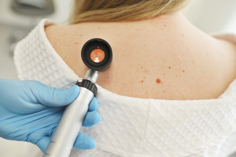 a dermatologist examines moles and skin growths on the patient's body using a special device - a