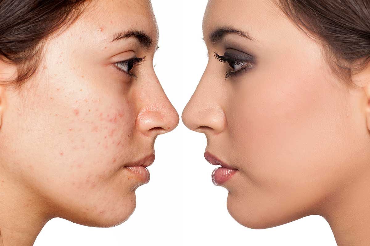 Get professional tips to safe your skin from Perfect Skin MD